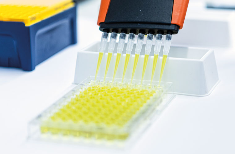 NAD-Diagnostik im Labor: NAD+- und NADH-Test zur Erkennung von Mangel oder Ungleichgewicht.